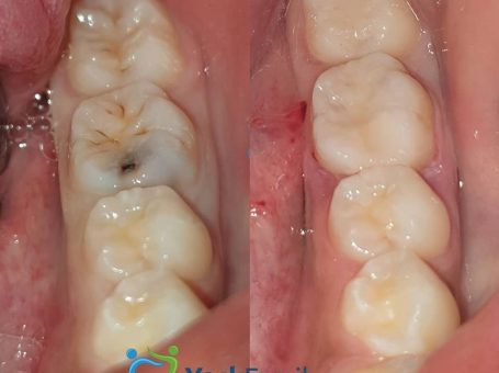 York Family Dental