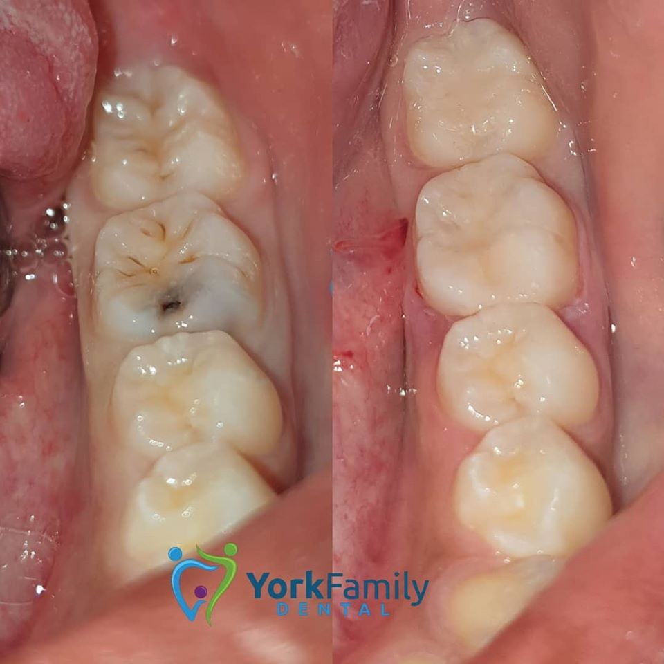 York Family Dental