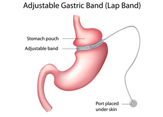 Endo-Laparoscopic Surgi-Centre